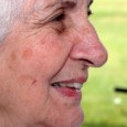 What is the difference between Age Spots, Sun Spots & Liver Spots? If you enjoy the sun and do not protect your skin, you may have experienced some changes in […]