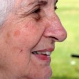 What is the difference between Age Spots, Sun Spots & Liver Spots? If you enjoy the sun and do not protect your skin, you may have experienced some changes in...