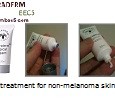 Please click play to view this video on What is Curaderm, How to Use Curaderm & Before and Afters Pictures. If you wish to view our latest Curaderm promotion, please visit...